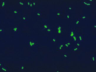 Fluoryzujące komórki bakterii Legionella pneumophila wyznakowanych przeciwciałami