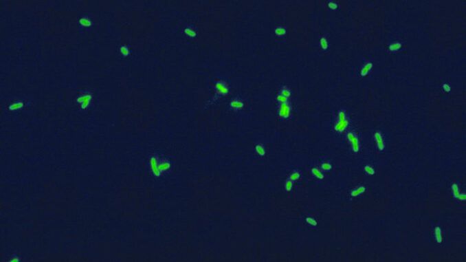 Fluoryzujące komórki bakterii Legionella pneumophila wyznakowanych przeciwciałami